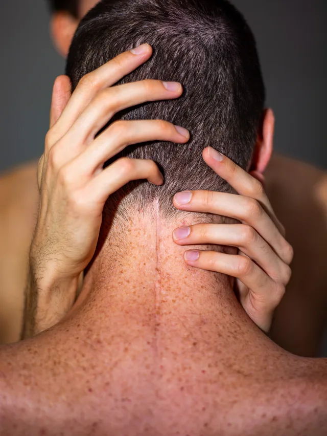Close-up of two hands holding the back of a person's head and neck.