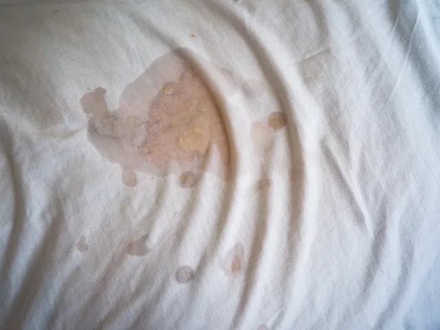 A translucent stain marks a rumpled white sheet.