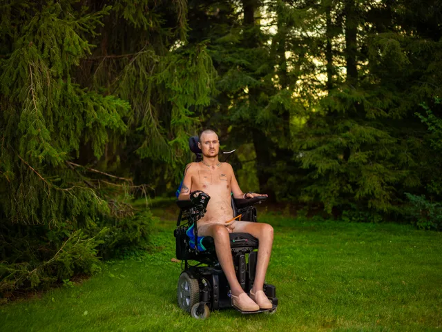 A nude wheelchair user sits alone on a lawn surrounded by trees.